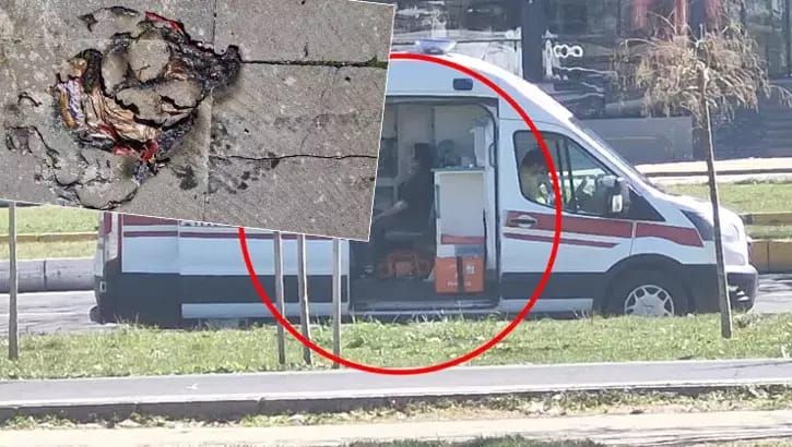 Helium şarlar bomba kimi partladı -  2 uşaq yaralandı-FOTO