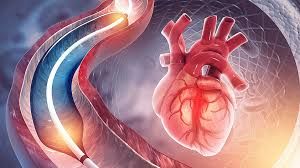 Ürək damarlarının tutulduğunu göstərən    8 əsas əlamət