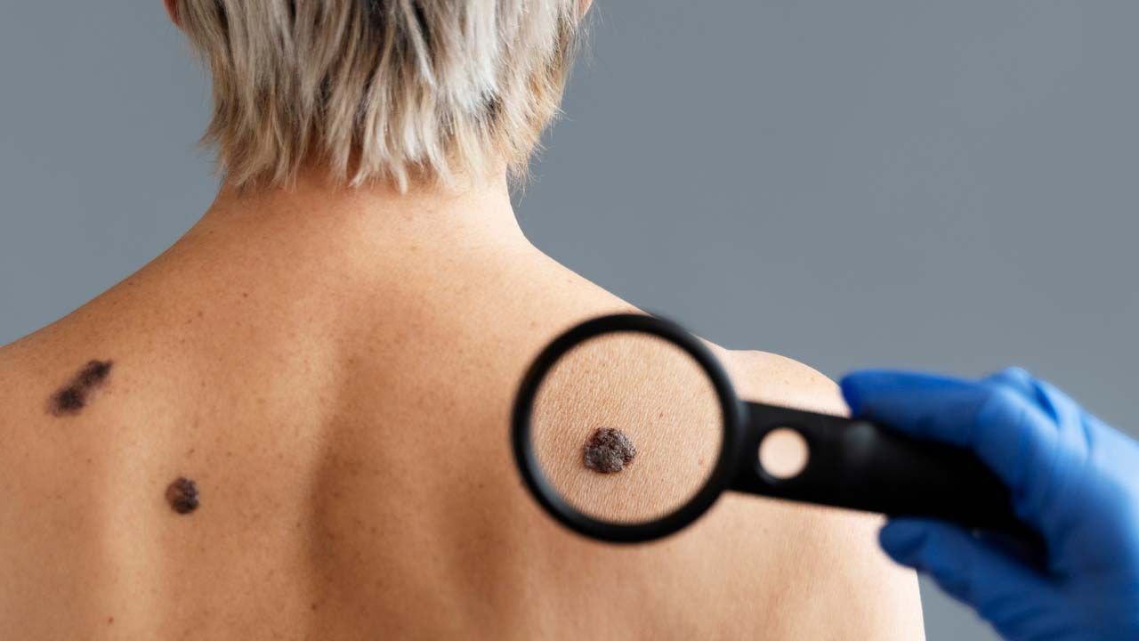 Xalı götürmək xərçəng yaradır? 