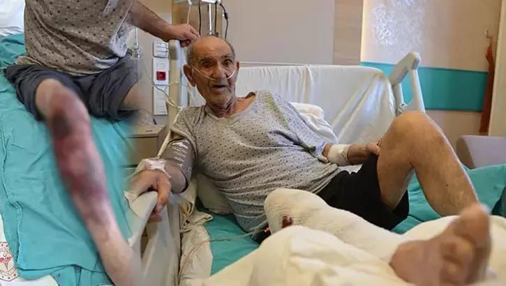 Təmizləyicisi vasitə ayağını yandırdı -  Xəstəxanalıq oldu-FOTO