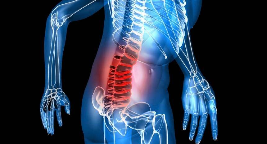 Çox yuxululuq və ağrılar mielomanın əlaməti  ola bilər