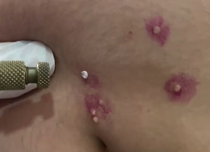 İdman zalından keçən yoluxucu virus- VİDEO