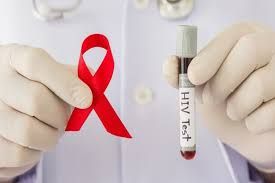 Azərbaycanda neçə HİİV xəstəsi var? 