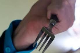 Yanağına çəngəl batan  oğlan    xilas edildi