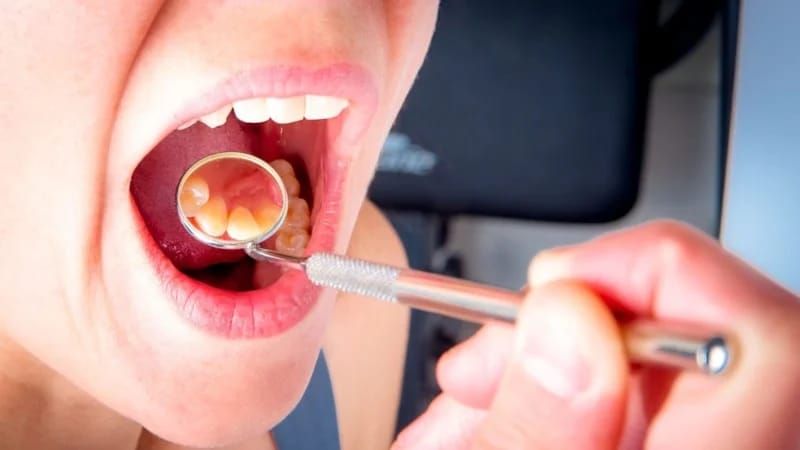 Şişən damaqlara diqqət:  Etdiyiniz səhv budur