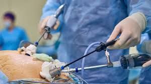 Mədə kəsilib götürüləndən sonra    insanı nə gözləyir?