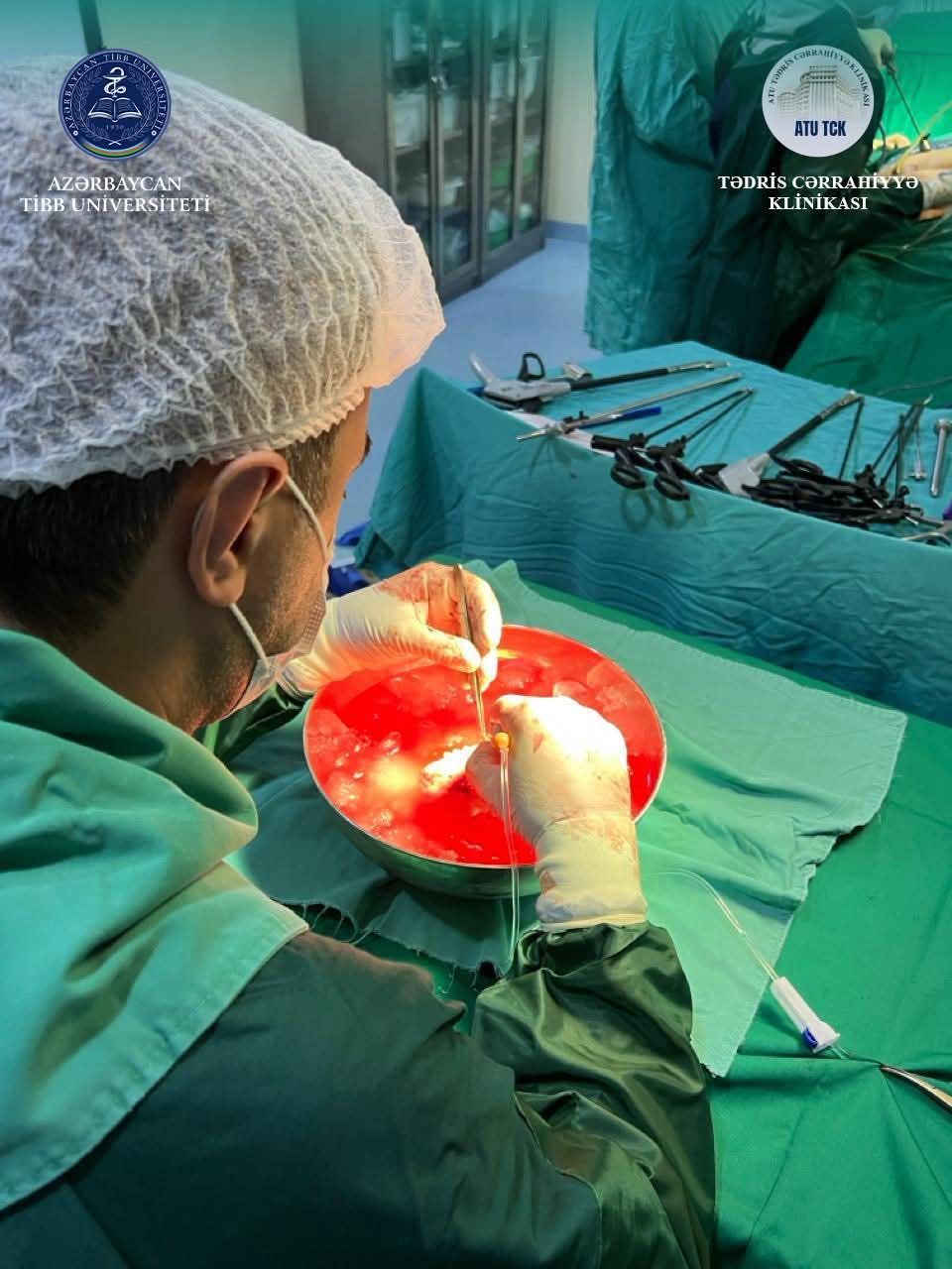 18 yaşlı xəstəyə anasından uğurlu böyrək transplantasiyası həyata keçirildi -  FOTO