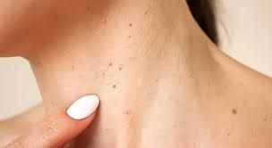 Bu simptomu ciddiyə almayanlar    peşman olur