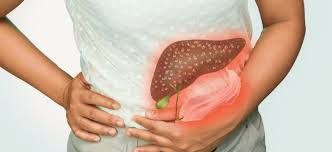 Yaşadığımız yer qaraciyər sirrozu    yarada bilər