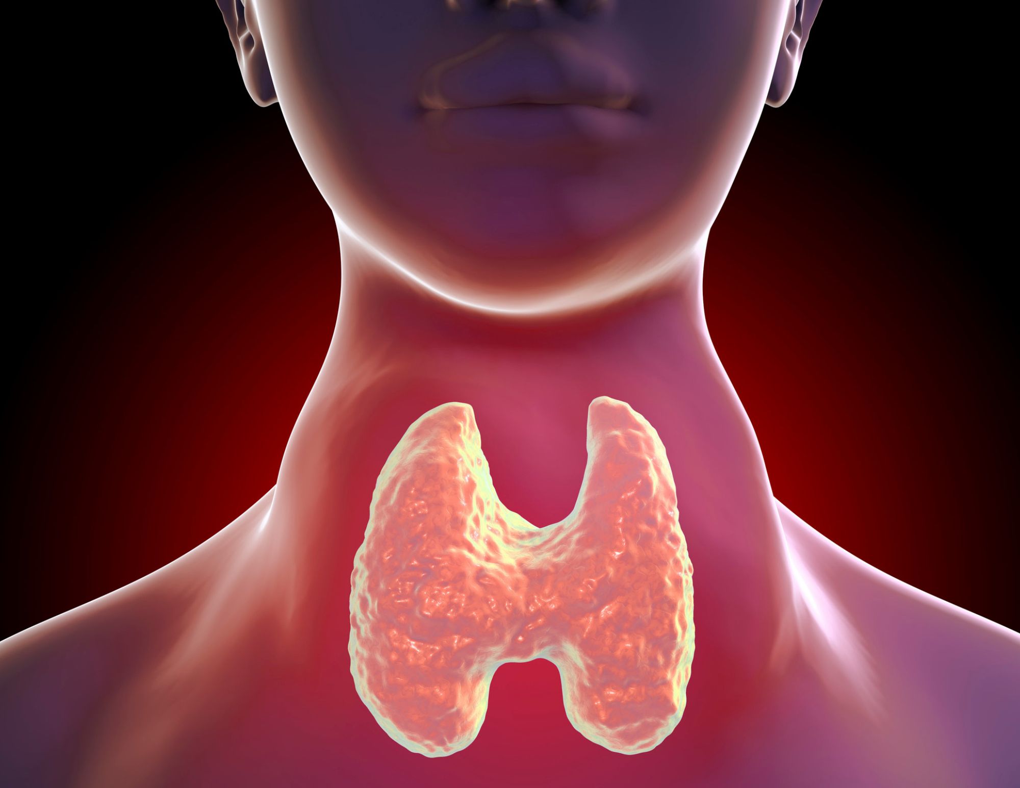 Zob xəstəliyində radioaktiv yod həmişə vacibdirmi? –  Mütəxəssislər fərqli yanaşmaları izah edir