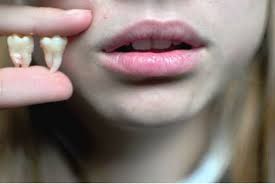 Ağıl dişi ilə insanın “ağlı” arasında əlaqə varmı? 