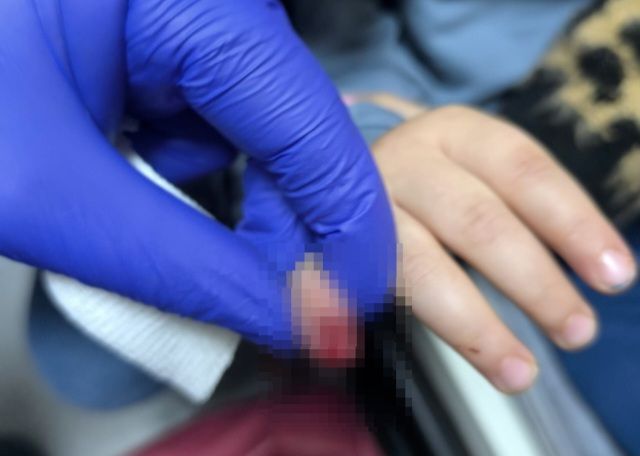 3 yaşlı uşağın əli eskalatorda qaldı -  Barmağı kəsildi