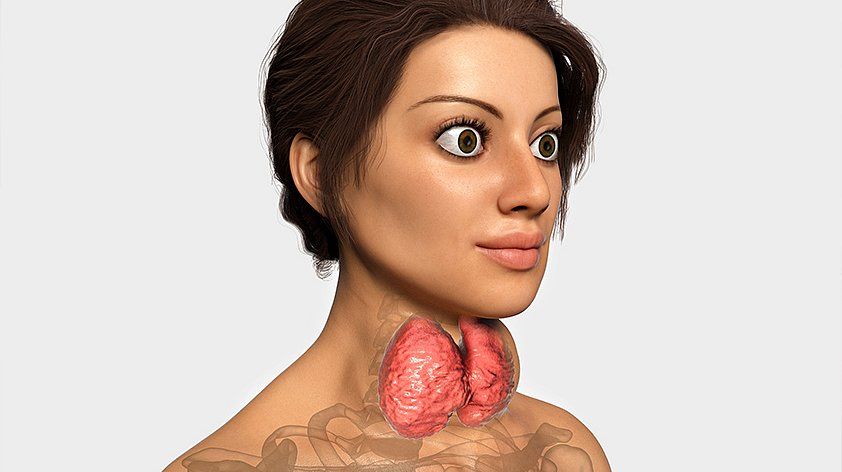 25 yaşlı qadına radioaktiv yod tövsiyə edildi -  İnteqrativ müalicə ilə əməliyyatsız nəticə əldə olundu