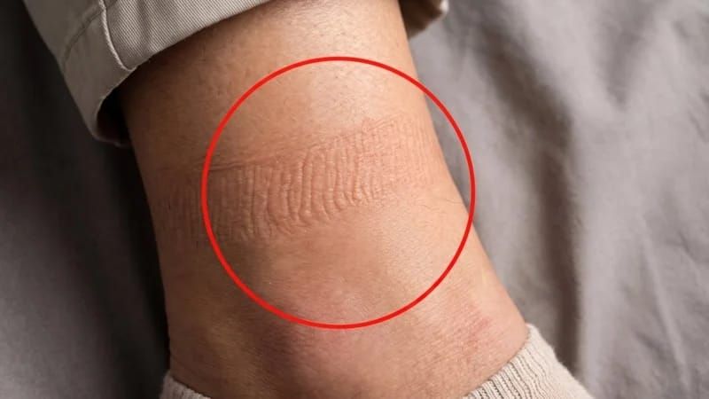  Corab izlərinə diqqət:  Əsl səbəbi budur