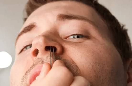 Burun tüklərini təmizləmək olmaz:  Səbəb