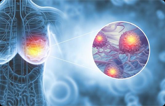 Mamoqrafiya “təmiz” olsa da, xərçəng necə aşkarlandı? -  Real pasiyent hekayəsi-VİDEO