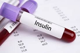 İnsulin 14-dən yuxarıdır    - Bu nə deməkdir?