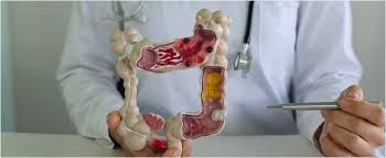 Bədəndə xoşxassəli düyünlər niyə yaranır?  