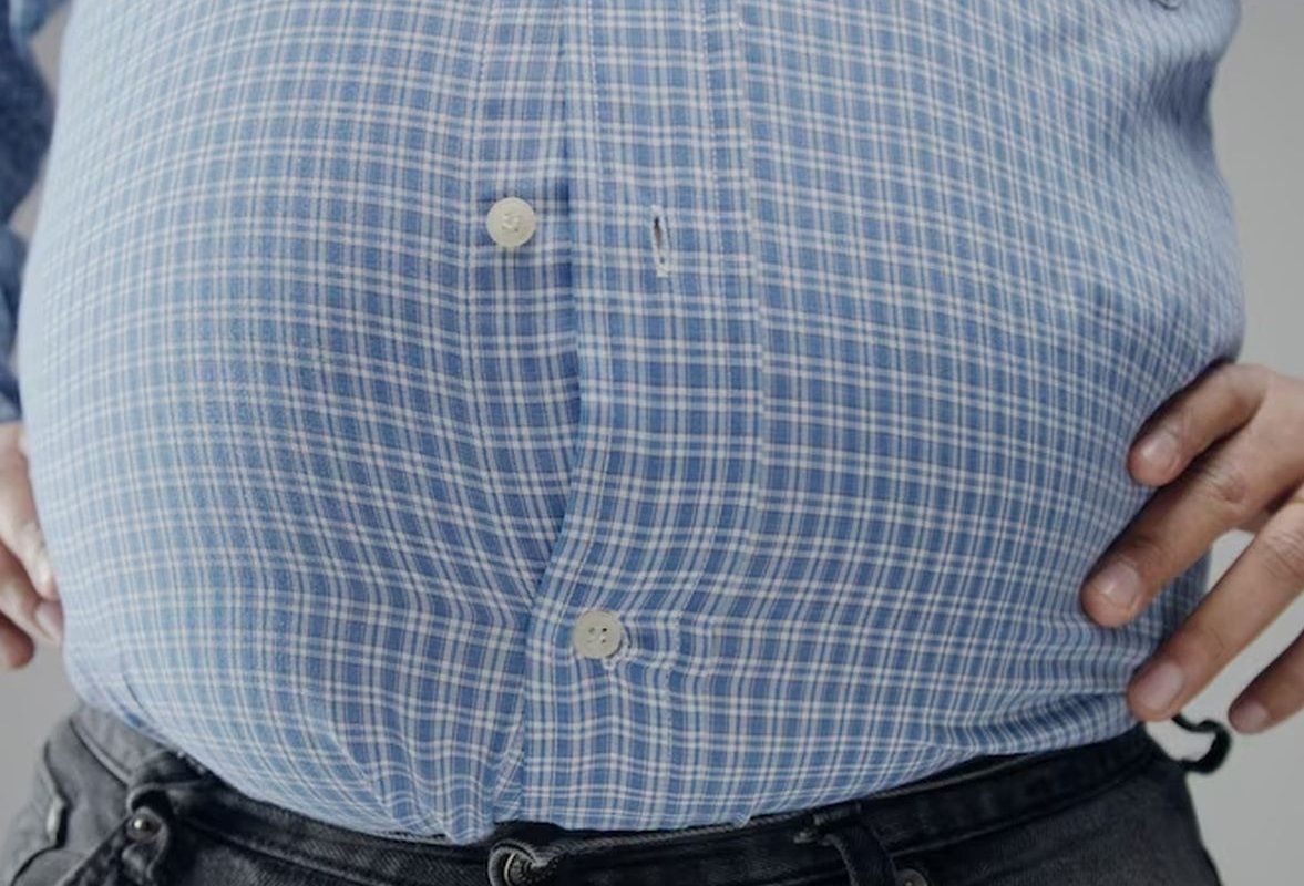 Qarın təkcə yeməkdən böyümür  – Səbəblər