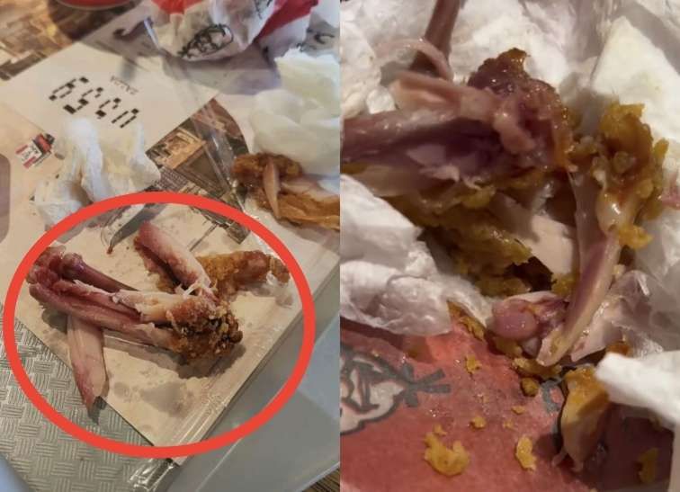 KFC müştərilərə qanlı toyuq satır? -  FOTO