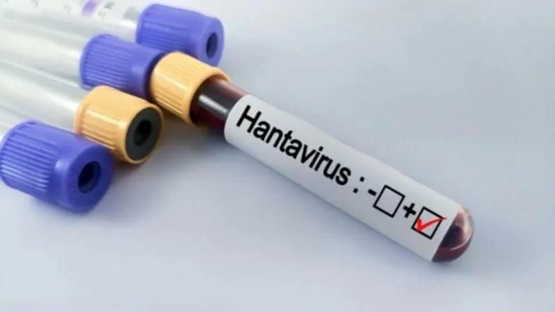 Hantavirus hansı ölkələrdə aşkarlanıb? -  Yoluxma artır