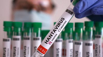 Hantavirus qripə bənzəyir -  Necə ayırd etməli?