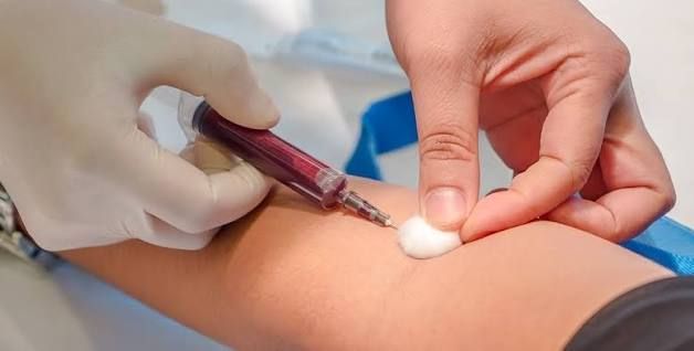 Azərbaycanda şəkər xəstələri insulin almaqdan ötəri  hər ay analiz verməlidir?