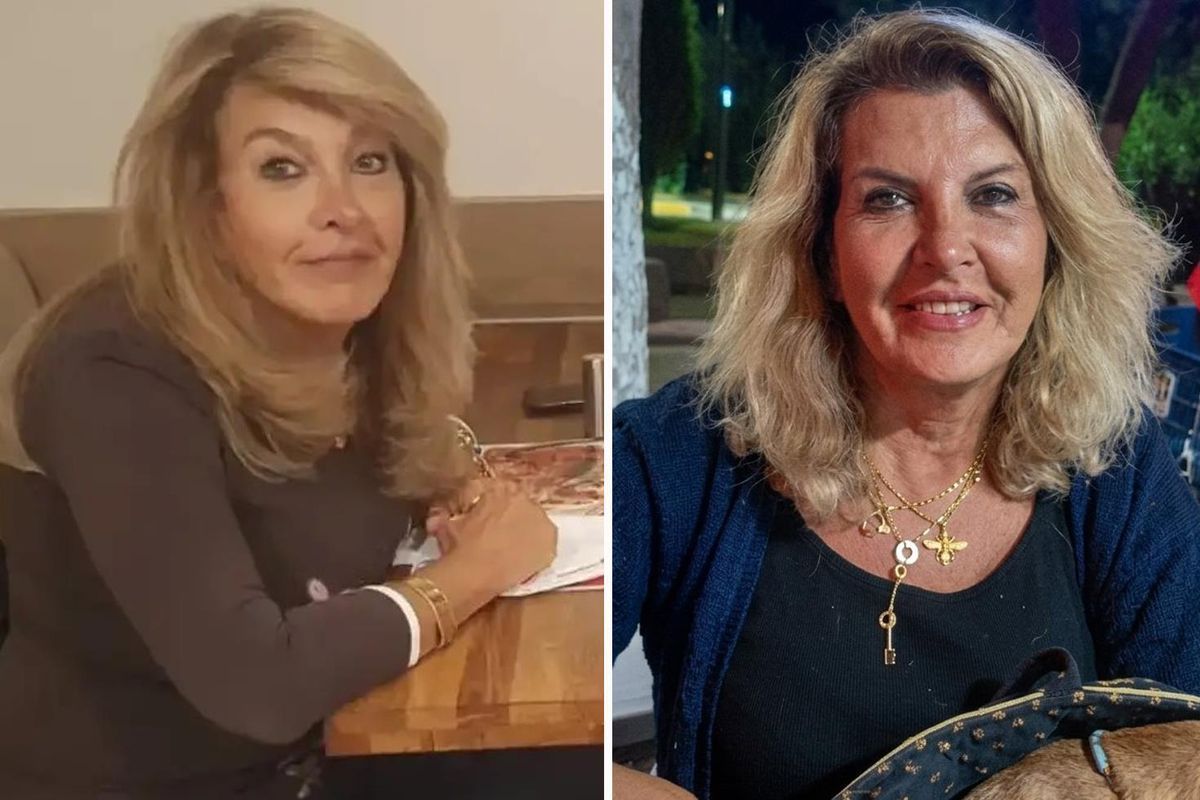 İtkin qadının kimliyi  implant və platinlə müəyyənləşdirildi