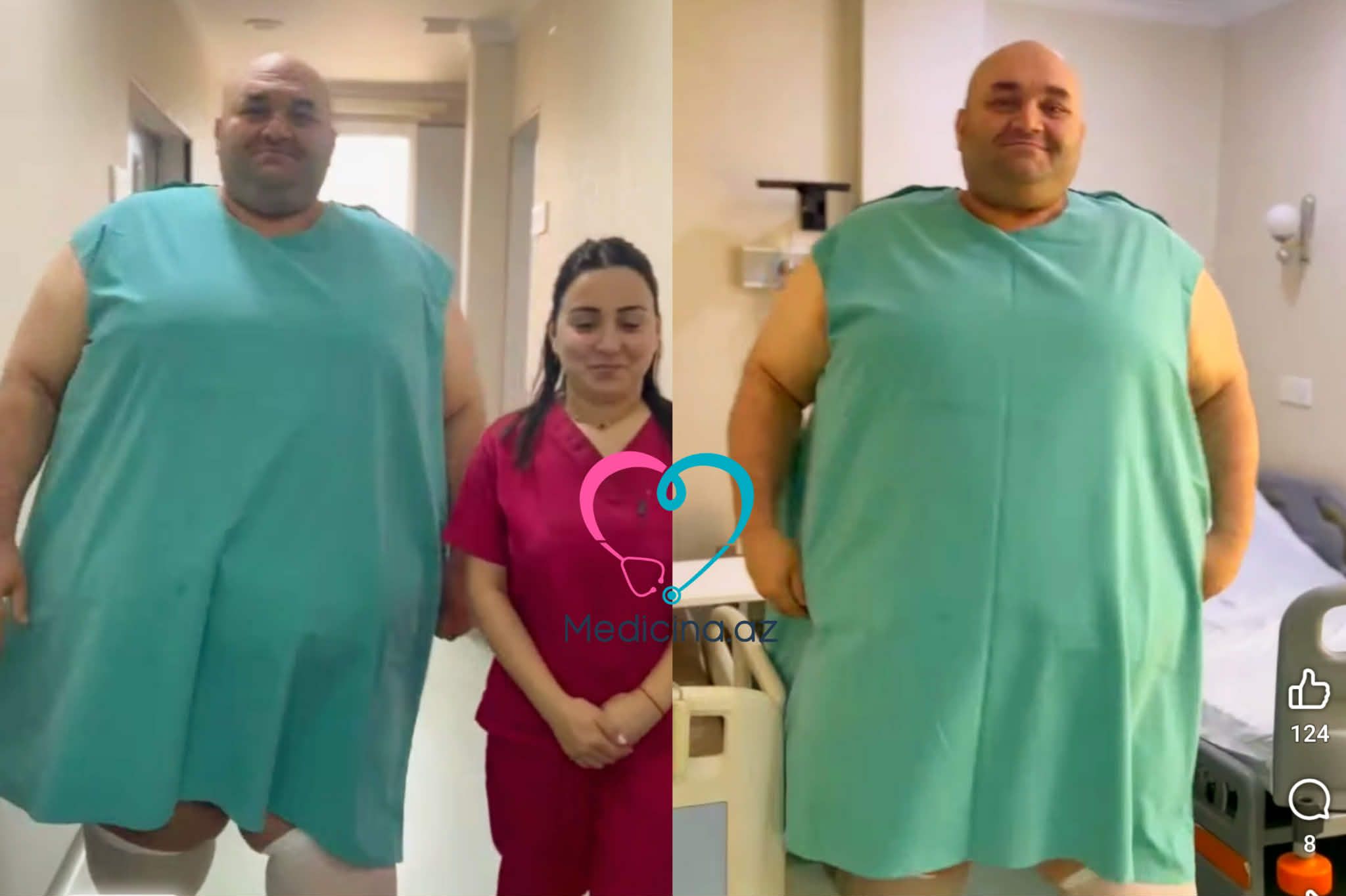 Azərbaycanda 330 kq çəkili kişi     əməliyyat olundu – Video 