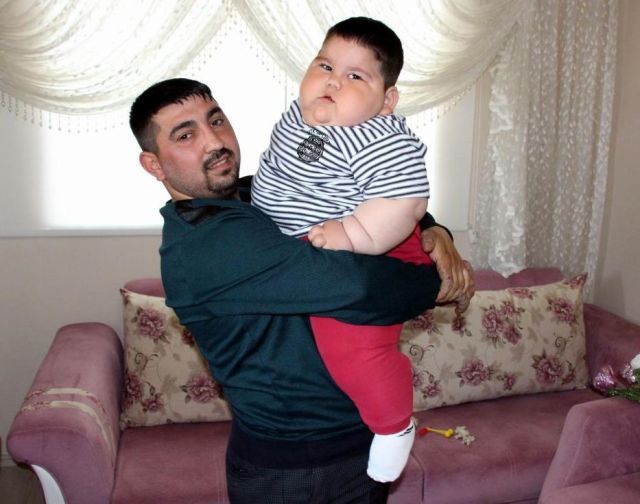 5 yaşında 90 kilo idi -  İndi onu görənlər tanıya bilmirlər-FOTO