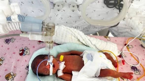650 qramlıq körpə doğuldu -  FOTO