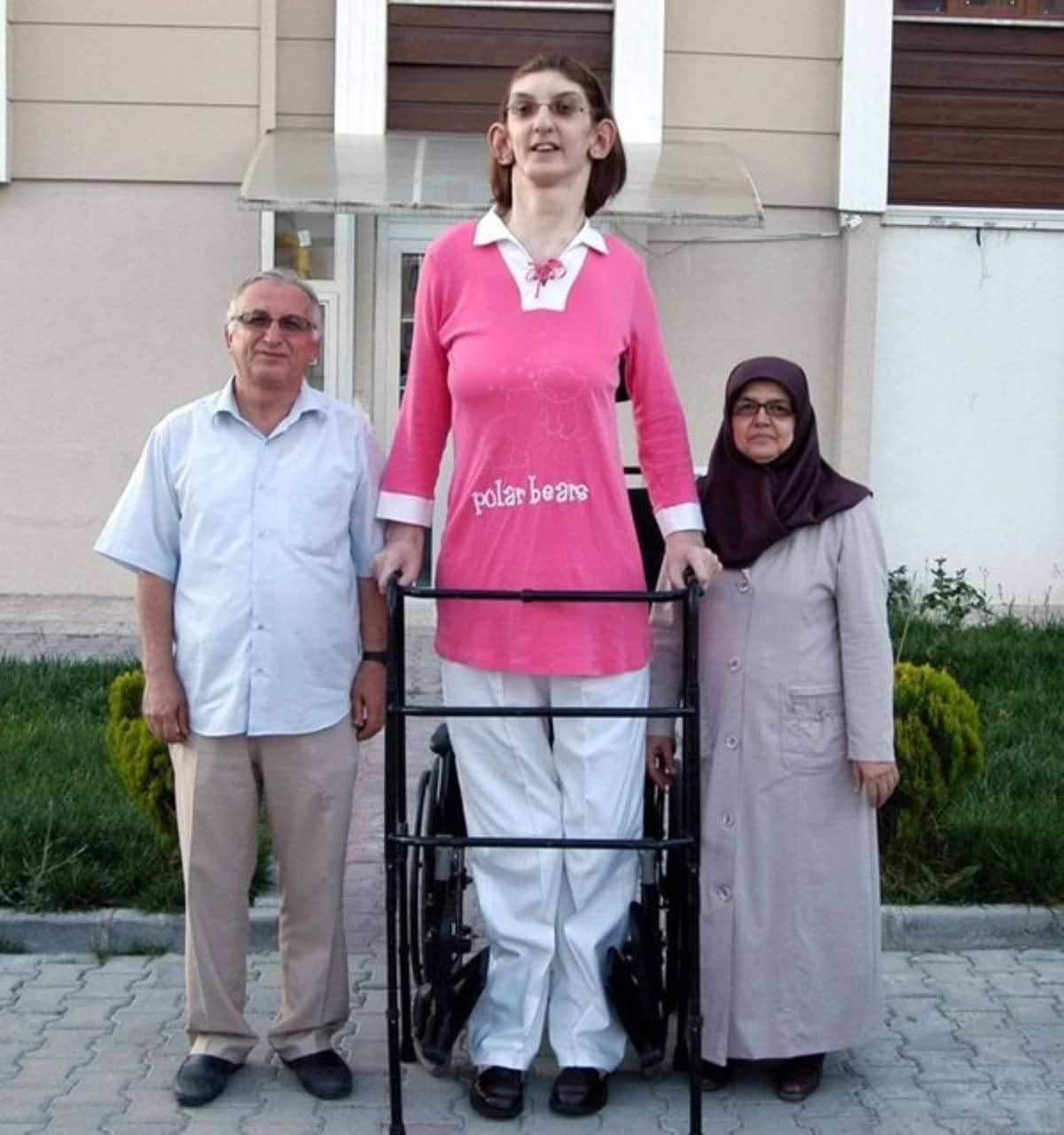 Dünyanın ən uzun boylu qadınının diaqnozu   məlum oldu