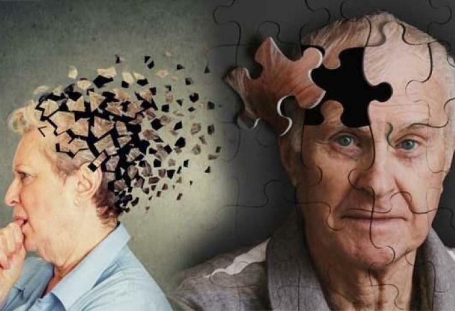 ÜST demensiyadan qorunmağın yollarını açıqladı 