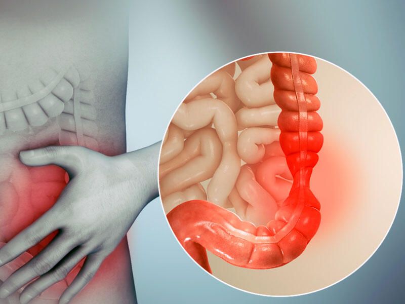 Hemoroid bildi,  xərçəng çıxdı