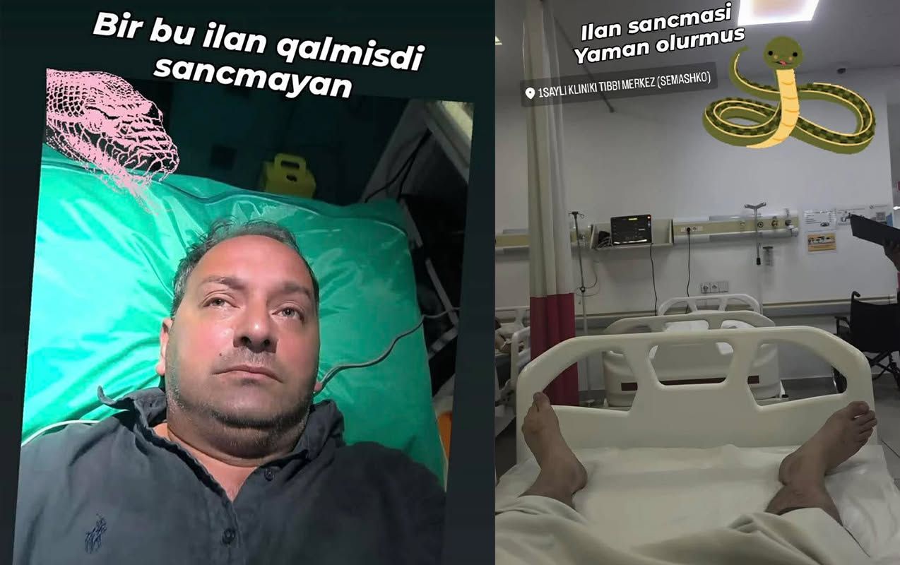 Elnur Kərimovu ilan sancdı -  FOTO