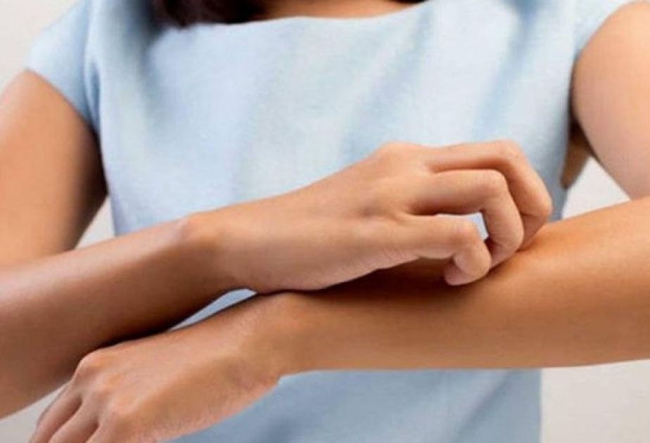 Qida allergiyasına qarşı yeni müalicə üsulu 
