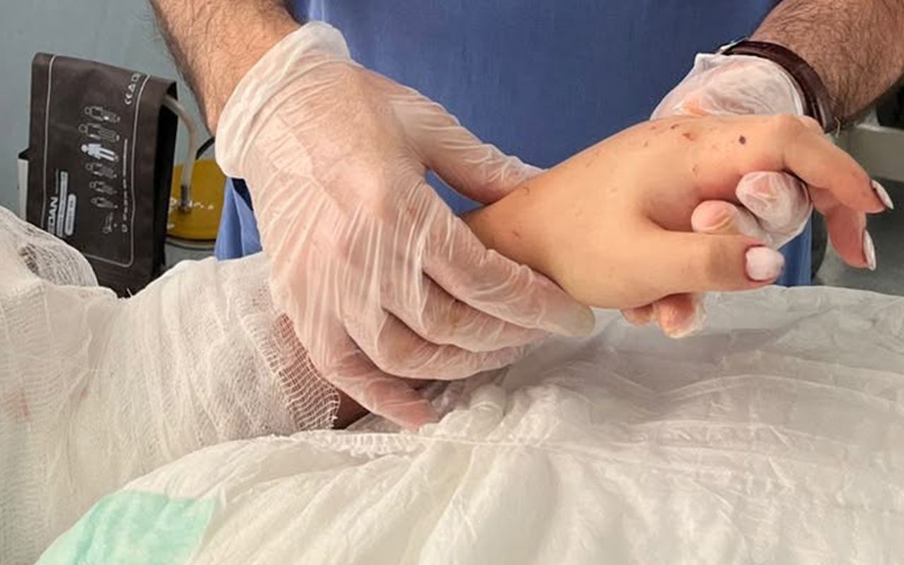 Bakıda qızın qopmuş qolu yerinə bərpa olundu -  FOTO