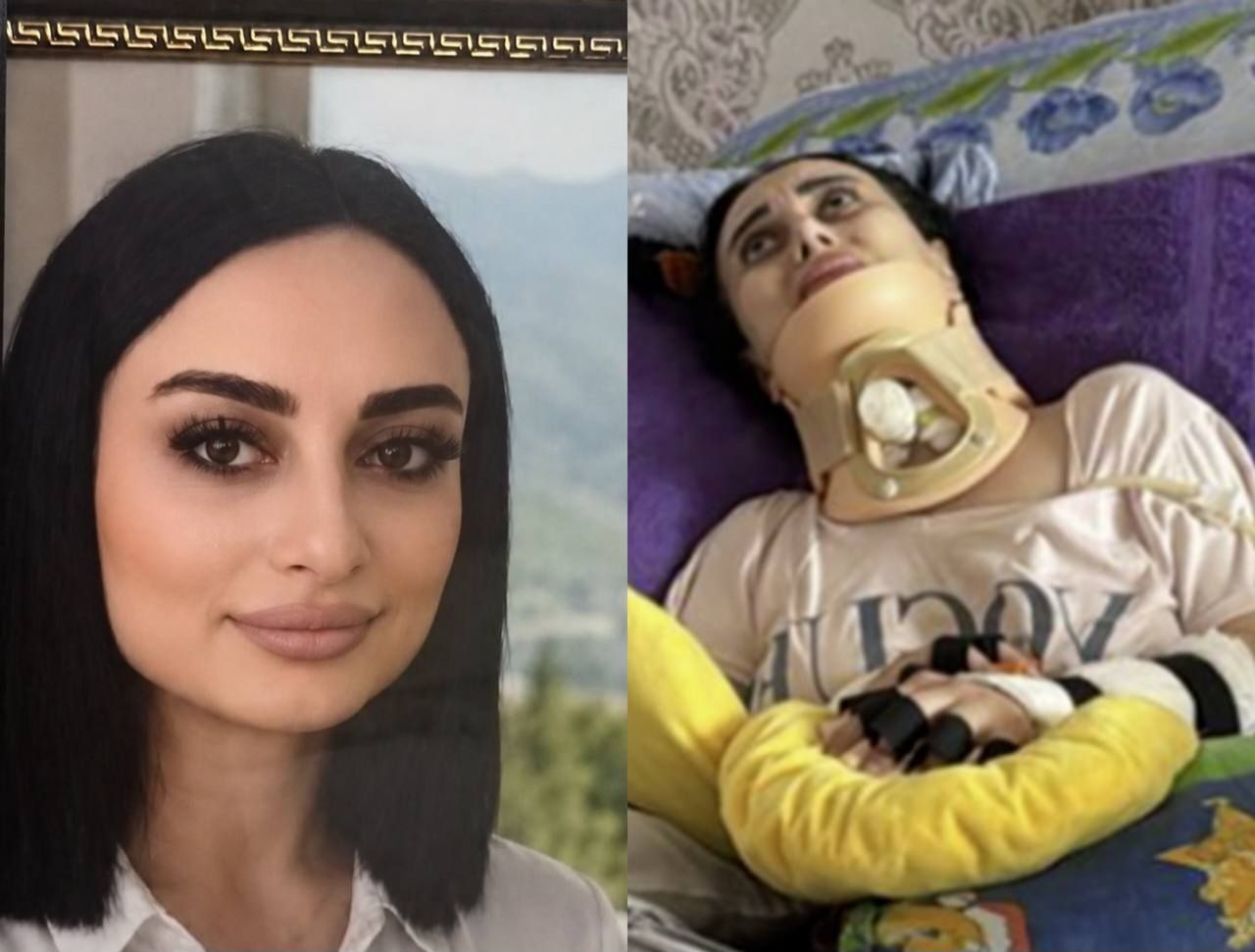 Əməliyyatdan sonra iflic olan Nigar vəfat etdi 