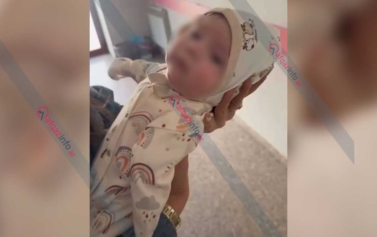 Ananın qolları olmayan körpəsindən imtina etməsi haqda rəsmi  AÇIQLAMA