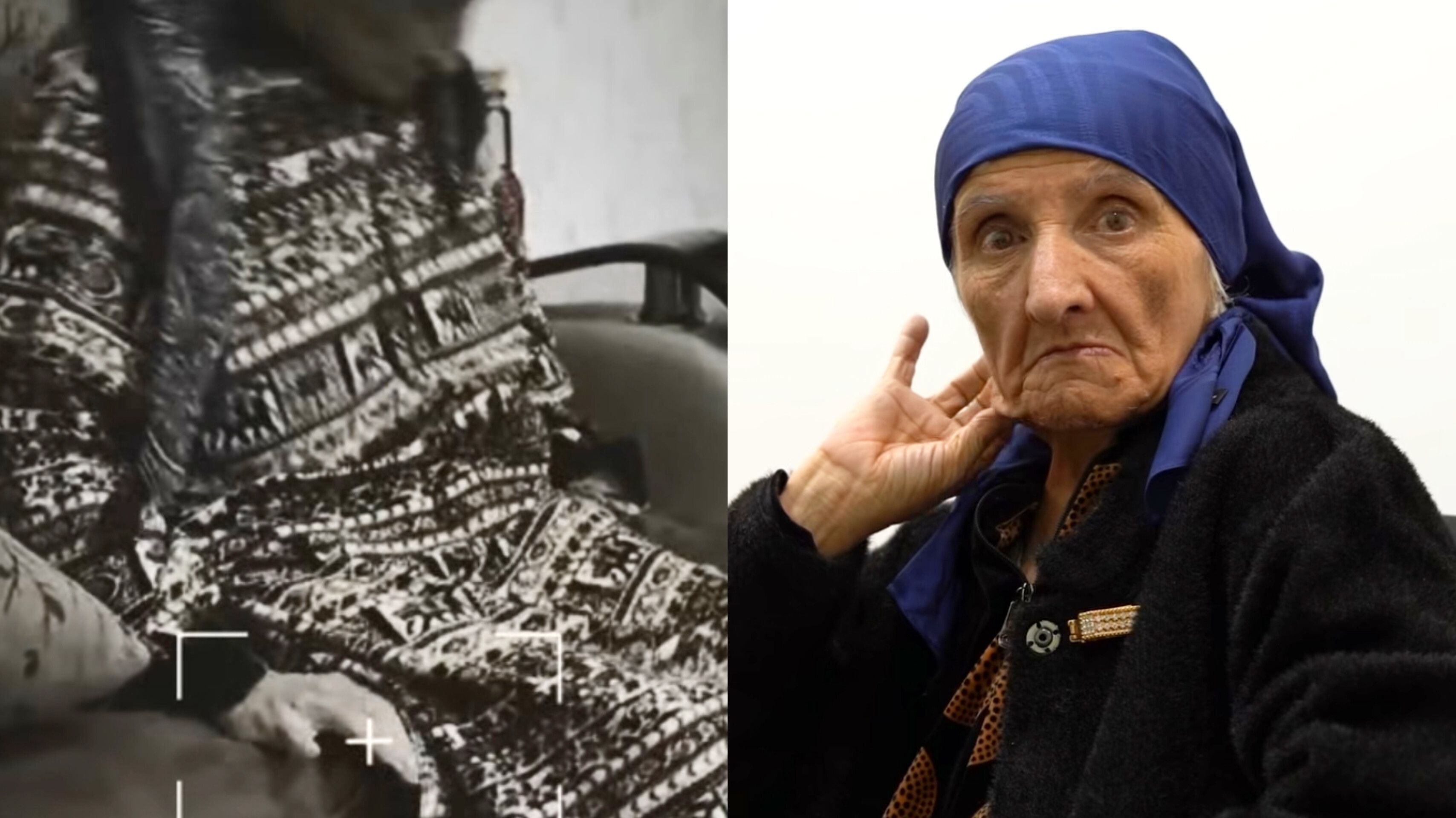 Parkinsonda yeni müalicə:  17 illik Parkinson xəstəsində hansı nəticələr əldə olundu? - VİDEO