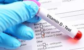 Vitamin D analizini vermək boşuna pul itkisidir  – Həkim