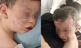 2 yaşlı uşaq vəhşicəsinə döyüldü -  FOTO