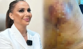 Həkim məni 3 dəfə əməliyyat edib pis vəziyyətə qoydu -  Daha bir məşhur cərrahdan ŞİKAYƏT