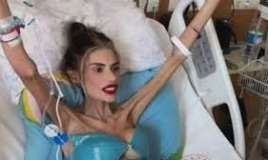  25 kiloya düşən Nihal Candan ölə bilər 