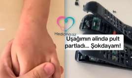 Bakıda azyaşlının əlində pult partladı -  VİDEO