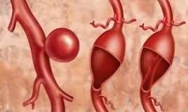 Hansı vitaminin əskikliyi damarları nazildir? 