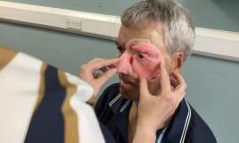  Üzü dağılmış kişini 3D printerlə bərpa etdilər 