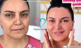 Bakıda qadının dəyişimi hamını şoka saldı -  VİDEO