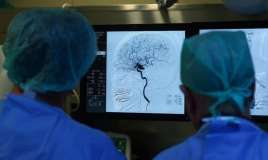 Həkimdən insultla bağlı xəbərdarlıq -  "Gənclər arasında çox yayılıb"