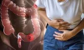 Bu cür qidalanma yoğun bağırsaq şişləri yaradır 